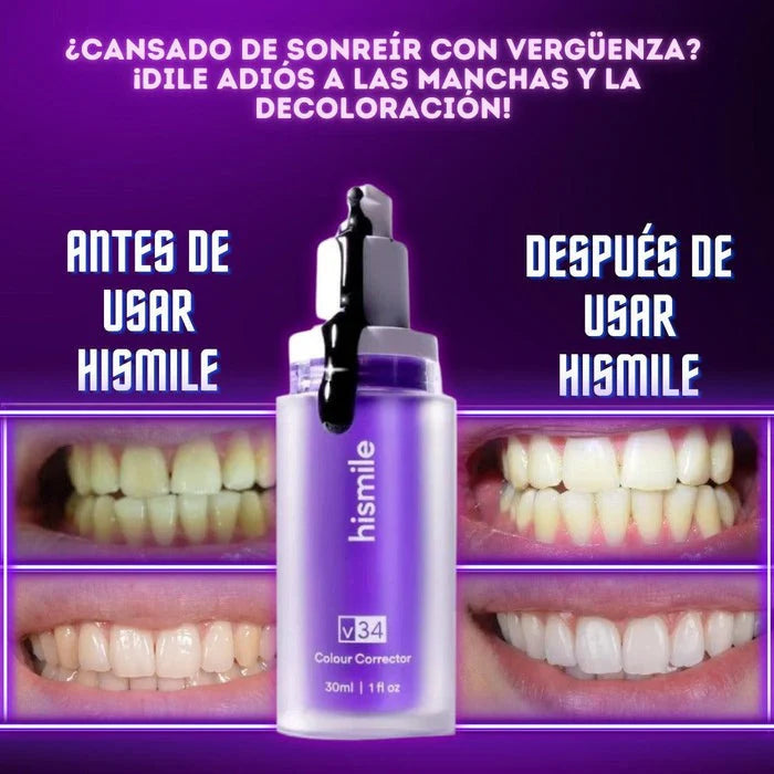 Hismile V34™ Luce una Sonrisa más Blanca al Instante